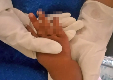 Bebê é internada por picada de inseto e acaba com dedo amputado