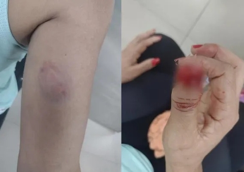 Treinadora arranca unha de aluna durante briga em academia