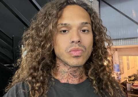 Vitão está careca e tem usado peruca em shows, revela colunista