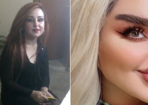 'Barbie iraquiana' choca ao aparecer irreconhecível após 43 cirurgias plásticas