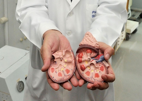 Pedra nos rins: Saiba o que acontece com seu corpo se condição não for tratada