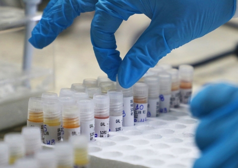 Mpox: Sobe para 16 o número de casos suspeitos no Amazonas