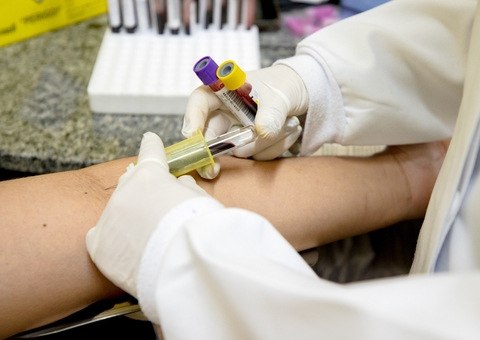 Manaus inicia oferta de novo teste para diagnosticar tuberculose latente