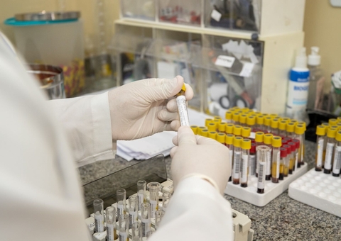 Manaus participa de projeto de prevenção a adoecimento e morte por Aids