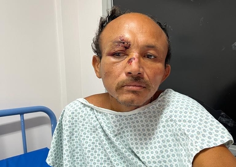 Hospital Platão Araújo procura família de homem atropelado em Manaus