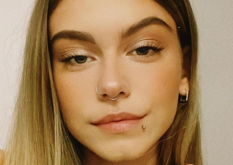 Universitária de 18 anos morre após contrair superbactéria por acne no rosto