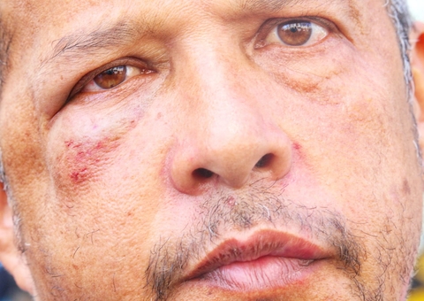 Entregador de app é agredido a socos por cliente em condomínio de luxo em Manaus