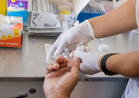 UBS's em Manaus iniciam novo serviço para redução de risco de infecção pelo HIV