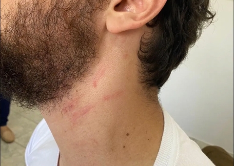 Delegado da PF invade escola e agride professor do filho: 'apontou arma na minha cara'