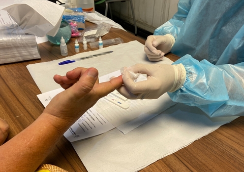 Casos de hepatites virais caem em 19% no Amazonas; saiba onde realizar teste