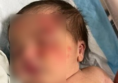 Cachorro de rua salva bebê abandonada em saco de lixo