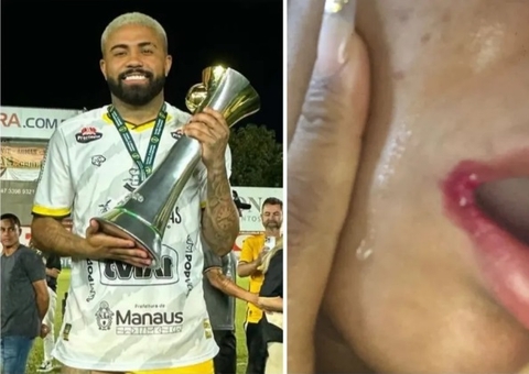 Ex-atacante do Amazonas, DG é acusado de agredir jovem em Belém