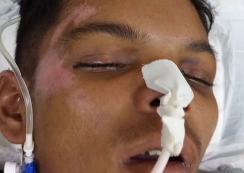 Hospital procura familiares de paciente internado por agressão em Manaus