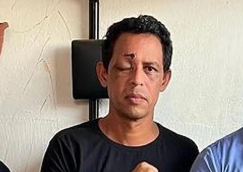 Policial que levou tiro no olho em rebelião em presídio do Acre faz campanha para tratamento