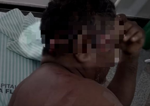 Indígena tem cabeça retalhada por onça-pintada