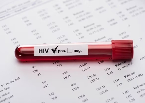 Mulher que foi deixada pelo marido ao receber teste falso positivo de HIV será indenizada