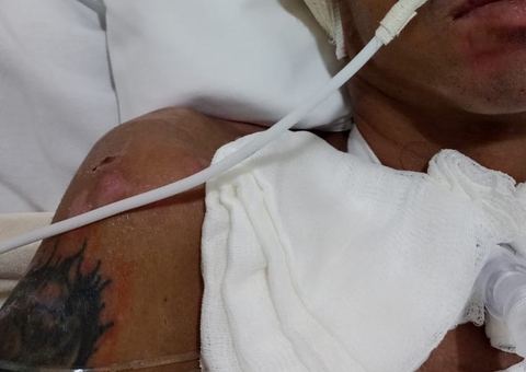 Hospital procura família de paciente internado após ser espancado em Manaus