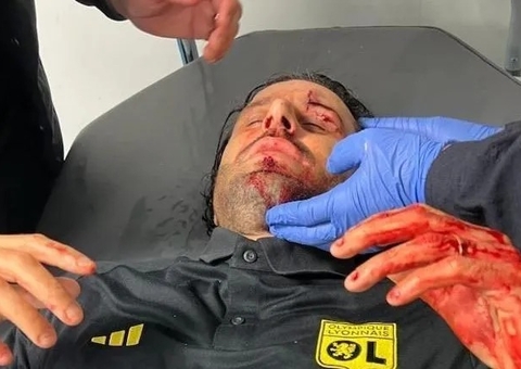 Técnico do Lyon fica ferido após ônibus do time ser apedrejado na França