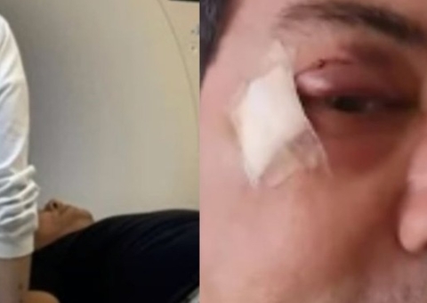 Vocalista do Calcinha Preta é atingido por barra de ferro em academia