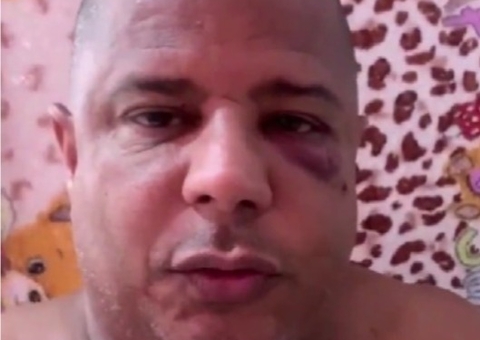 Com olho roxo, Marcelinho Carioca reaparece após ser sequestrado: 'saí com mulher casada'