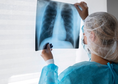 Diagnóstico precoce favorece tratamento e cura da tuberculose