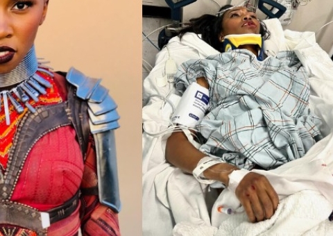 Atriz de Pantera Negra sofre ferimentos graves após ser atropelada