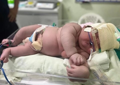 Bebê gigante que nasceu com 7,3 kg no Amazonas faz 1 ano; veja como ele está