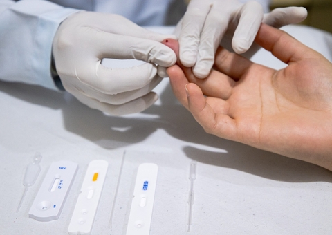 Manaus conta com 9 unidades de saúde que ofertam PrEP; confira