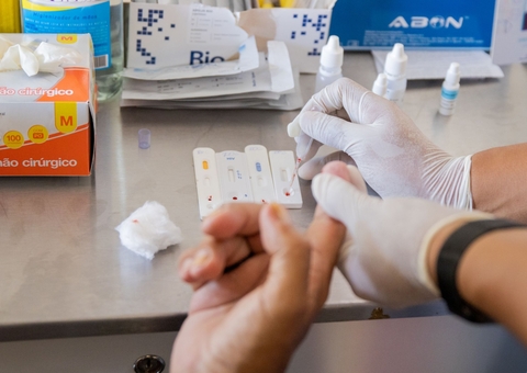 Rede de atendimento às pessoas vivendo com HIV em Manaus é ampliada