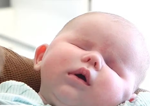 Em condição rara, bebê nasce sem os olhos
