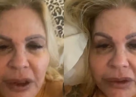 Abatida, Monique Evans diz que não consegue comer após contrair dengue