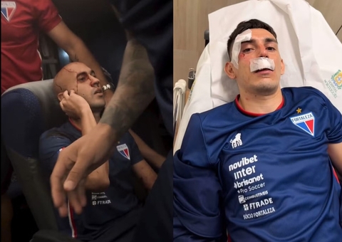 MP-CE diz que acionará CBF por punição ao Sport após ataque a ônibus