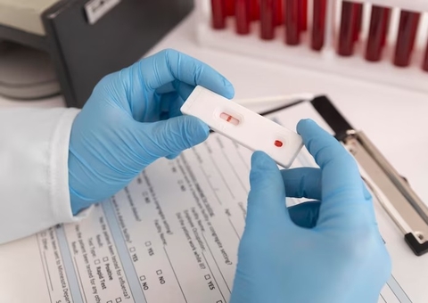 Novo teste de HPV no SUS pode antecipar diagnóstico em até 10 anos