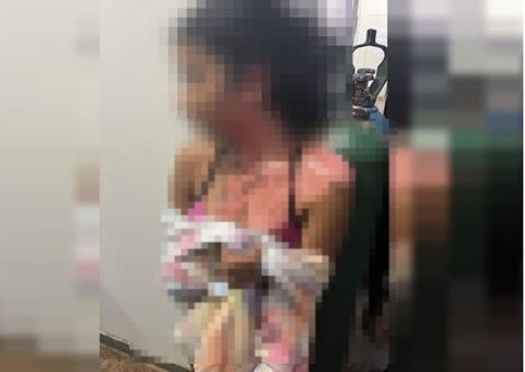 Polícia busca por tia que queimou sobrinha de 14 anos por ciúmes do marido