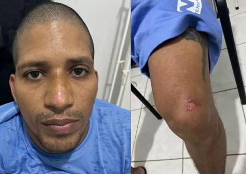 Fugitivo de Mossoró tinha lesões pelo corpo após recaptura, aponta laudo