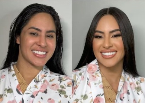 Globo proíbe “publis” e manda ex-bbbs apagarem posts 