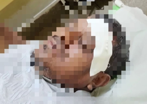 Vereador sofre acidente com motocicleta em Maués