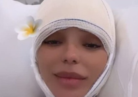 Brunna Gonçalves faz cirurgia para reduzir testa: 'realizei um sonho'