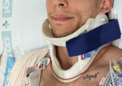 Ator de 'La Casa de Papel' sofre acidente e passa por cirurgia