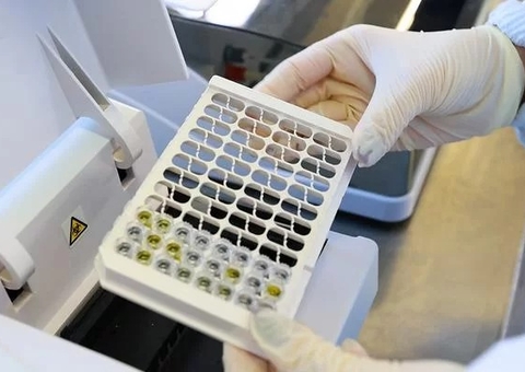 Rio Grande do Sul investiga mais de 800 casos suspeitos de leptospirose