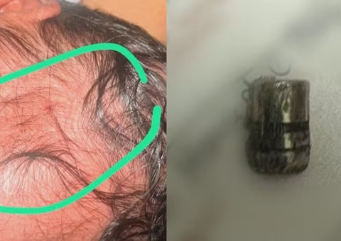 Recém-nascida é atingida por tiro em hospital  4 horas após o nascimento