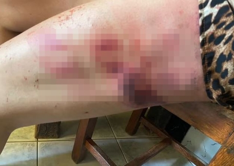 Pai espanca filha com terçado por dívida de R$ 950