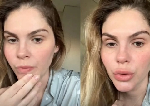 Na UTI, filho de Bárbara Evans tem melhora e sai da sedação 