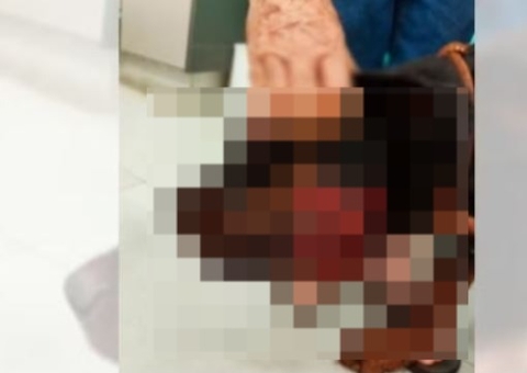 Onça mata pit bull e fere rottweiler em sítio