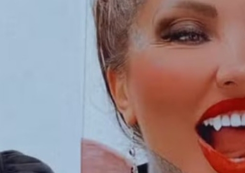 Após 6 litros de silicone, Sabrina Boing Boing troca dentes por presas