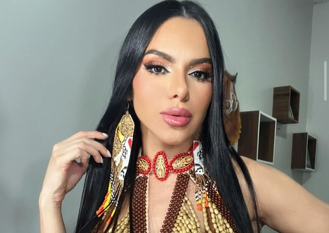 Musa do Garantido e affair de Davi impressiona com antes e depois de procedimentos estéticos