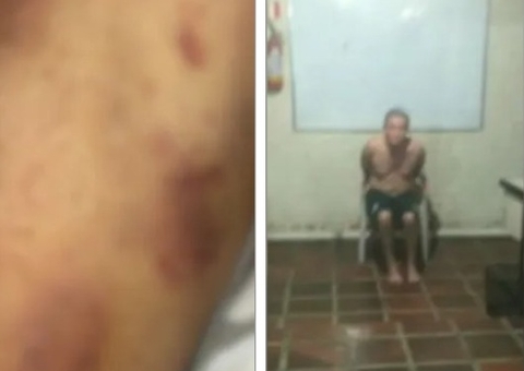 Vídeo: Paciente morre após tortura em clínica; laudo aponta lesões frequentes