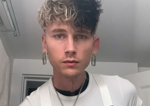 Bizarro: Ex de Megan Fox implanta presas de vampiro nos dentes