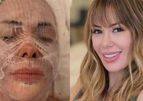Influencer relata tratamento facial à base de cocô de pássaro 