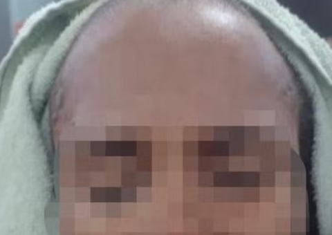 Homem agride a esposa a marteladas e a obriga a raspar o próprio cabelo